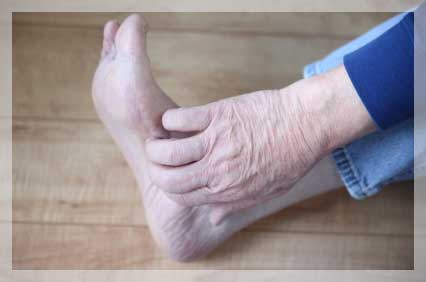 Liken Planus
