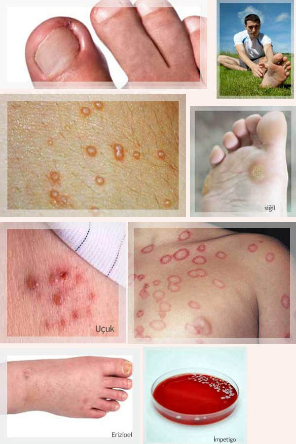 Spor Dermatolojisi